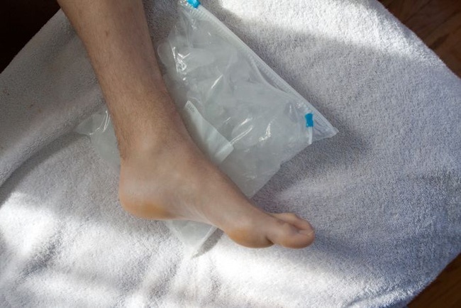 Bong gân co nên chườm nóng không?
